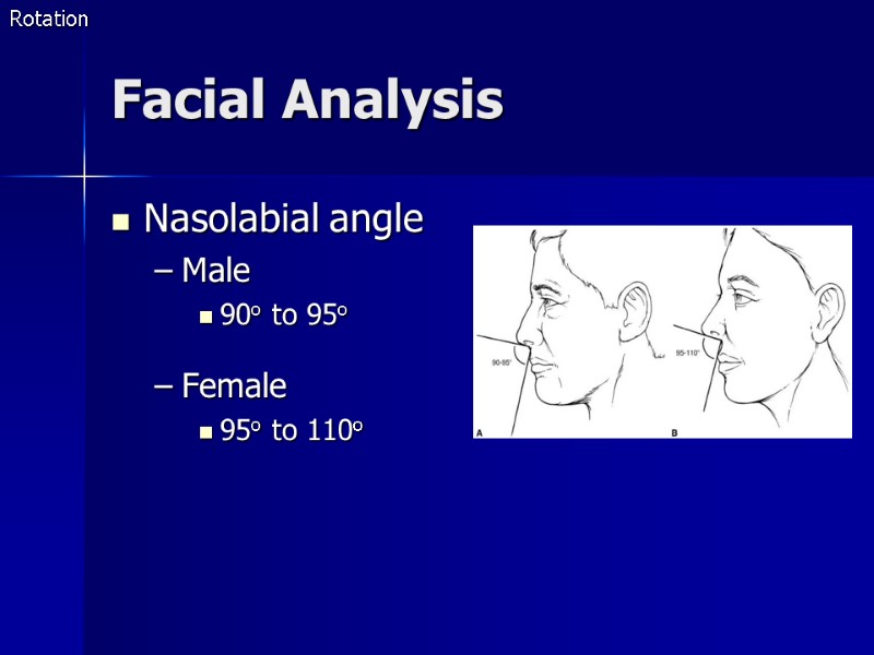 >Facial Analysis Nasolabial angle Male 90o to 95o  Female 95o to 110o 